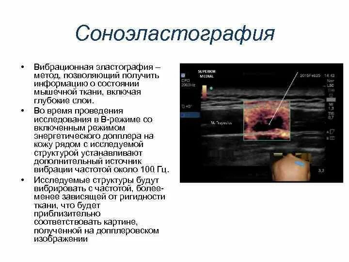Эластография эластография чем отличается. Эластография (эластометрия) печени. Ультразвуковая эластография молочной железы. Эластография печени протокол узи. Компрессионная эластография протокол.