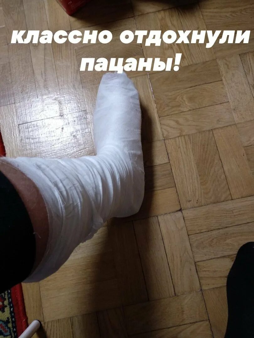 сломанная нога приколы