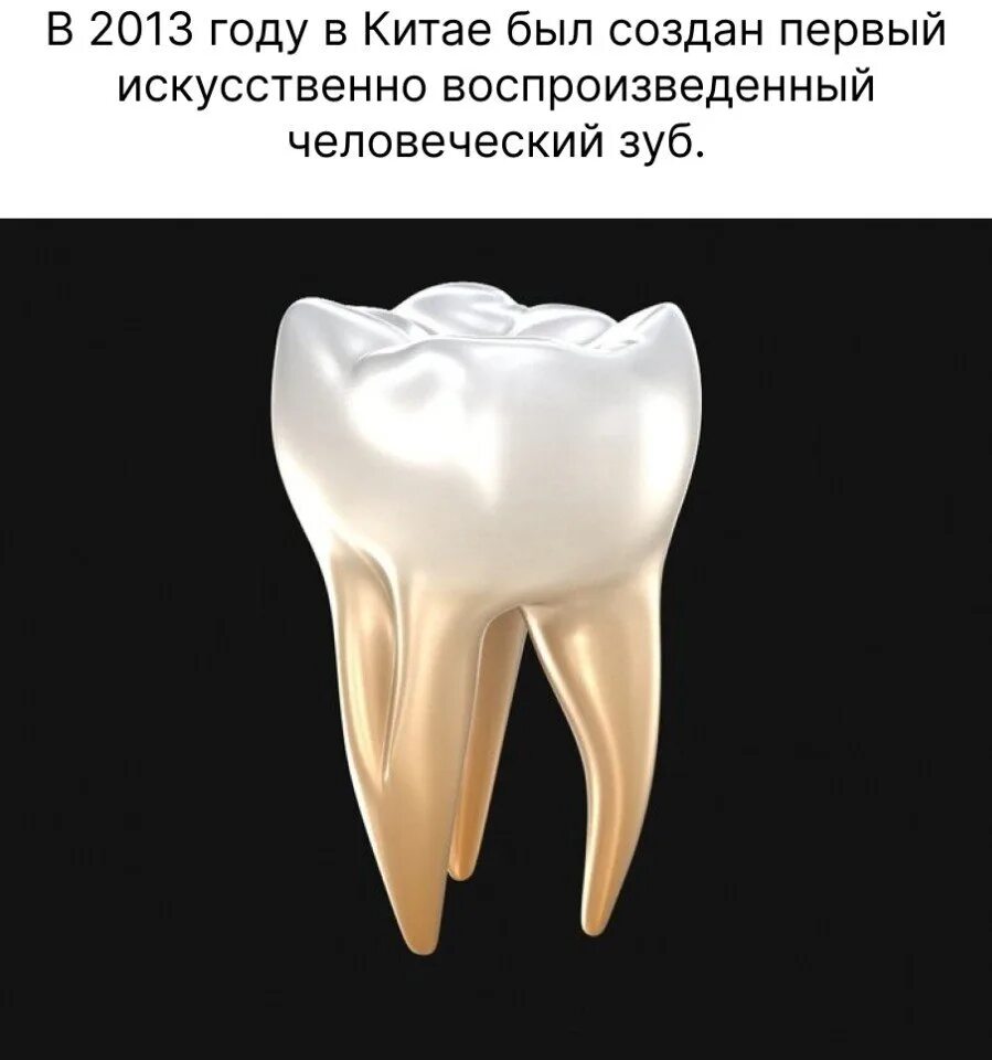 Удаление зубов - "Сложный случай - 20550 рублей потрачено, и 3 зуба мудрости уда