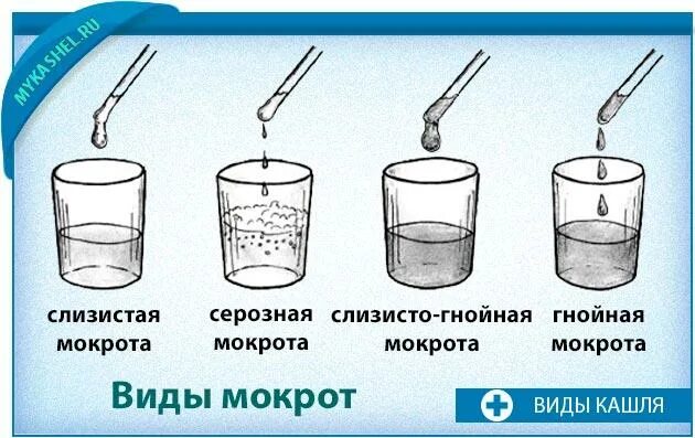 Малиновая мокрота. Слизистая серозная гнойная мокрота. Мокрота слизисто Гнойного характера. Цвет слизисто-гнойной мокроты. Слизисто серозная мокрота.