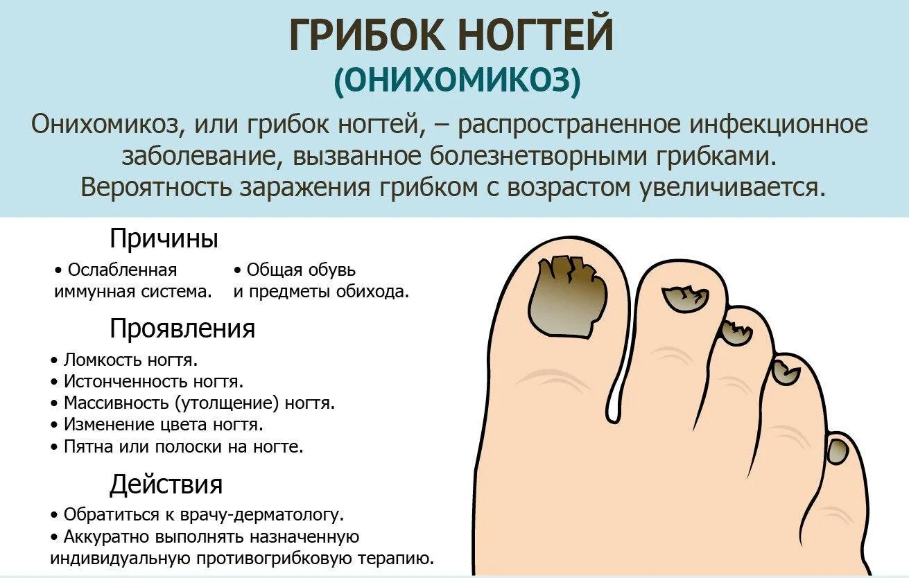 Соберите информацию о грибковых заболеваниях. Грибковые заболевания ногтей схема. Онихомикоз — грибковое поражение ногтей.. Грибковые заболевания ногтей на ногах.