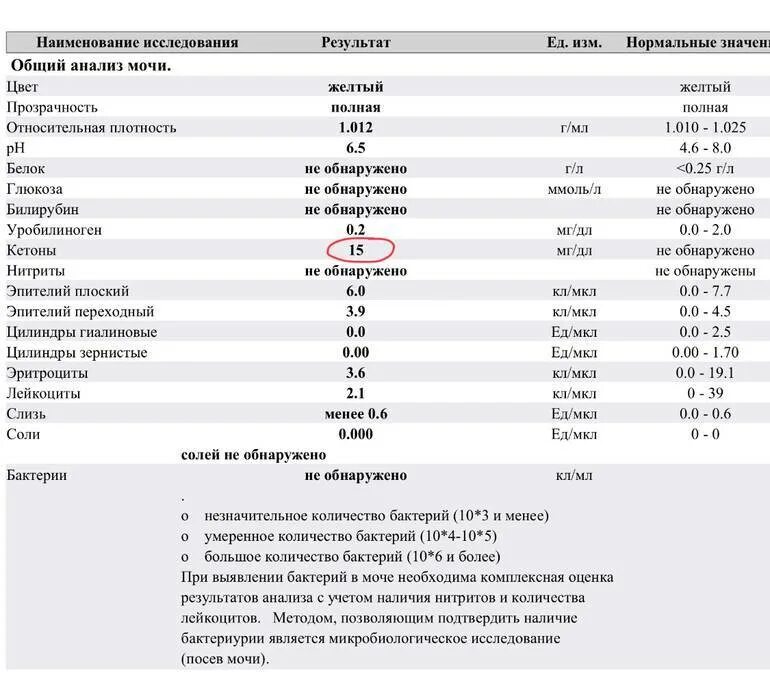 Глюкоза в моче повышены причины. Норма мочи ацетона у детей. Ацетон в моче норма. Анализ мочи ацетон норма. Показатели Глюкозы в моче норма.