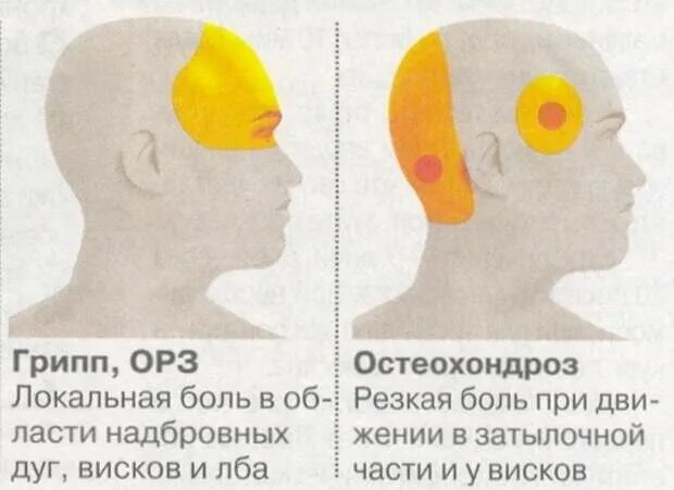 Болит левая часть затылка. Области головной боли. Причины головной боли. Затылочная часть головы. Болит затылочная часть головы причины.