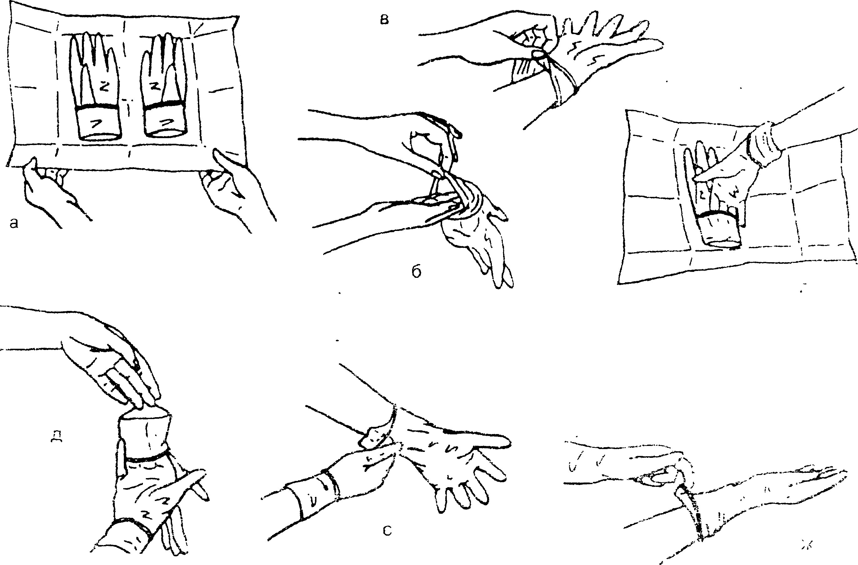 Надевание стерильных перчаток алгоритм. Техника одевания стерильных перчаток. Одевание стерильных перчаток алгоритм. Одевание стерильных перчаток на хирурга алгоритм.