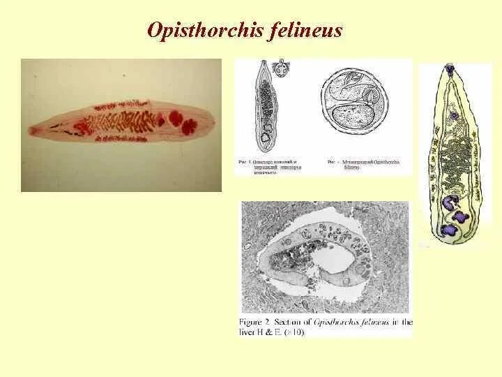 Лямблиоз статистика заболевания. Шистосома яйца. Описторхоз клиническая картина. Ланцетовидный сосальщик. Дифиллоботриоз антропоноз.