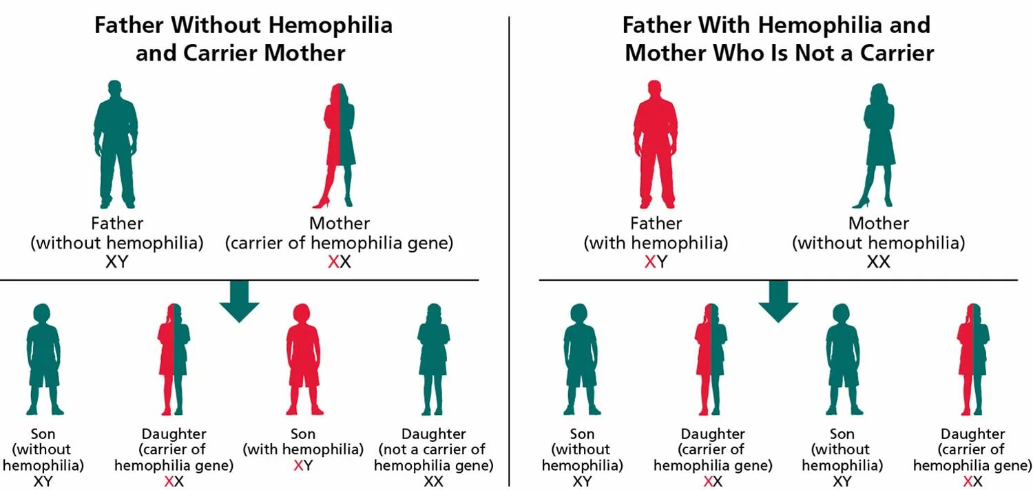 Дети больные гемофилией. Hemophilia Genetics.