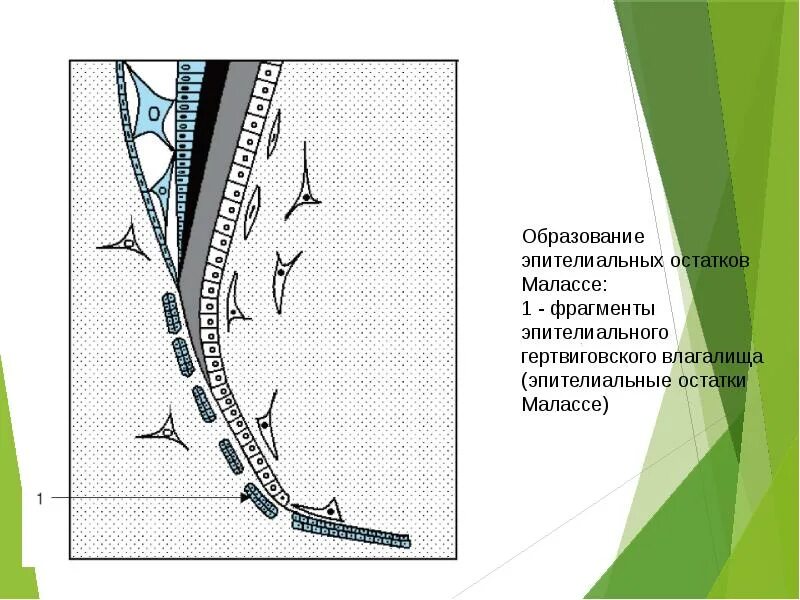 Дист ло. Эпителиальные островки Малассе. Эпителиальные остатки Малассе. Клетки Малассе. Образование эпителиальных остатков Малассе.