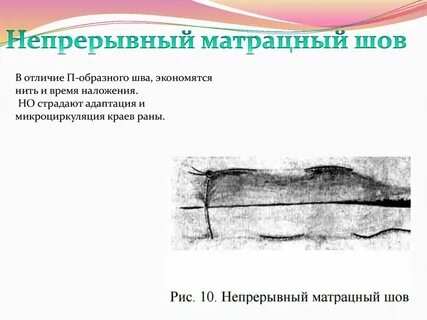 П непрерывного