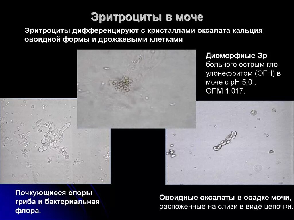 Моче слизь эритроциты