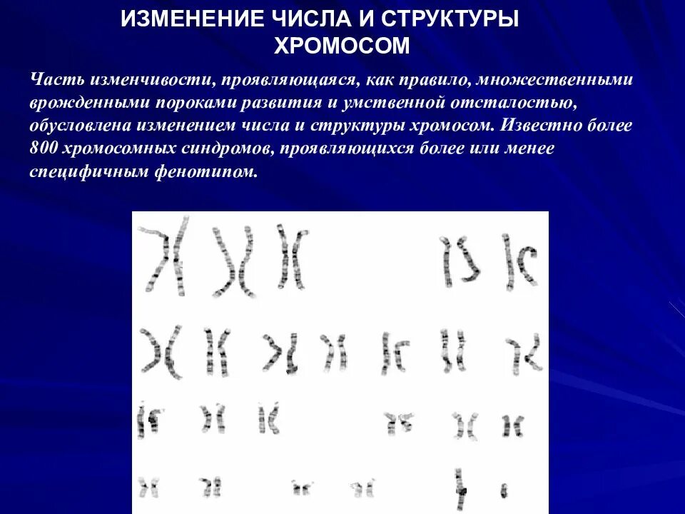 Удвоение хромосом какая мутация. Изменение структуры хромосом. Измененная структура хромосом. Изменением числа или структуры хромосом. Заболевания с изменением структуры хромосом.