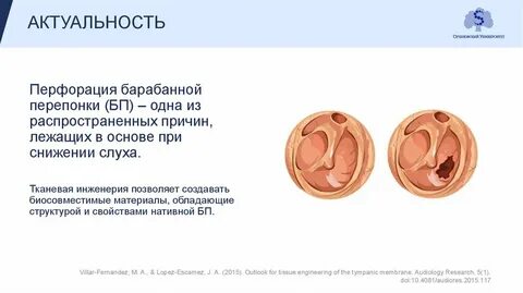 Тест с ответами отит