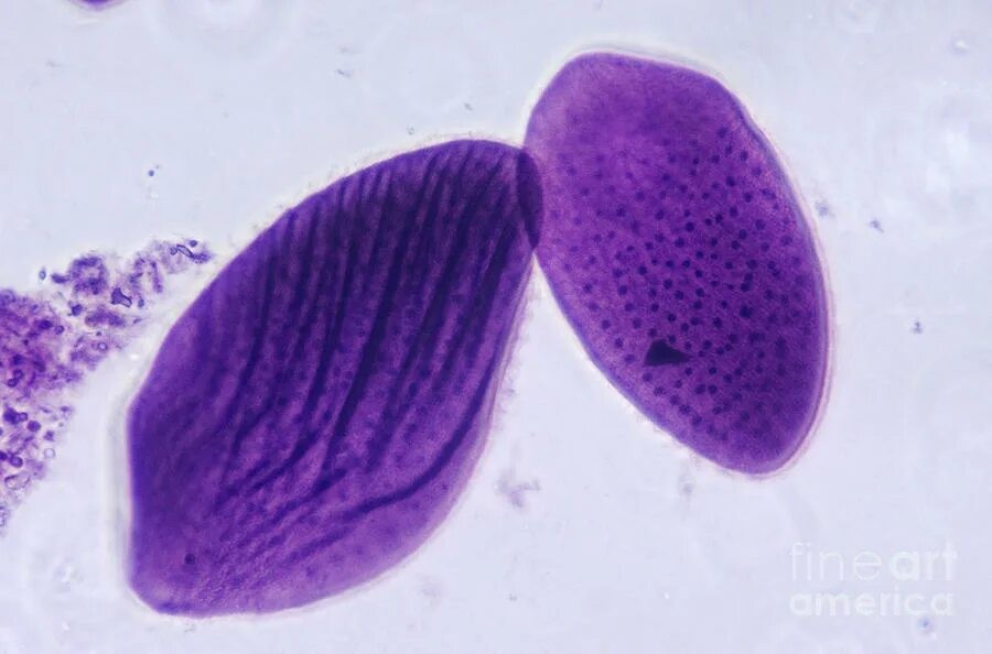 Opalina ranarum жизненный цикл. Opalina ranarum. Опалина. Опалина лягушачья. Опалина лягушачья (opalina ranarum).