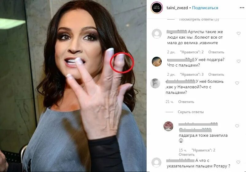Болезнь началовой на руках. Болезнь началовой на руках. Болезнь началовой на руках. Болезнь началовой на руках. Болезнь началовой на руках.