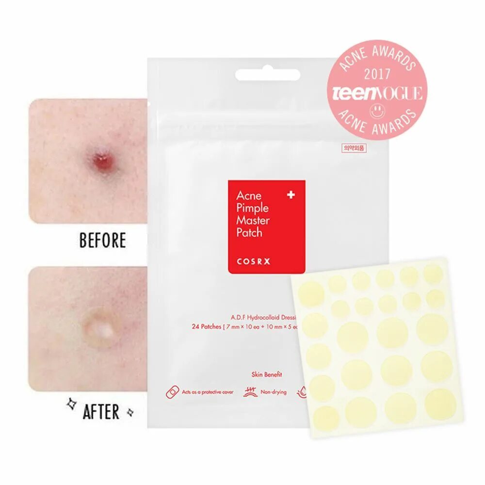 Acne pimple. Патчи против акне прозрачные - acne pimple master patch. пластыри от прыщей cosrx acne pimple master patch. патчи от прыщей corxs.