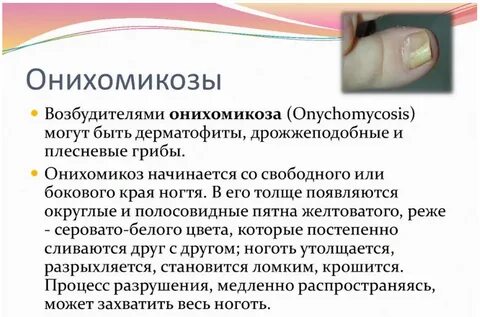 Онихомикоз лечение препараты