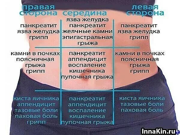 Колет там. Болит в области живота. Болит живот в области живота. Ноющие боли в области живота. Схема боли в животе.