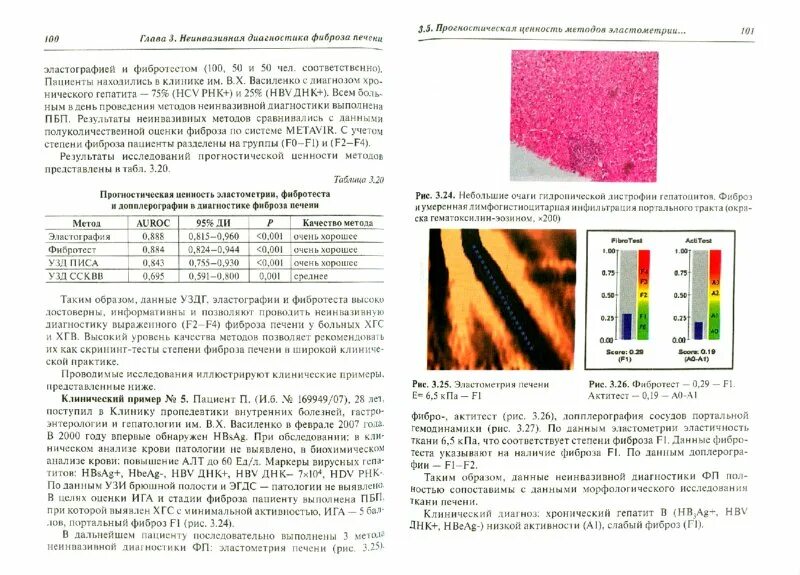 Эластография печени протокол УЗИ. Эластография (эластометрия) печени. Выявление фиброза печени. Эластография печени протокол. Фиброз печени 2 степени лечение