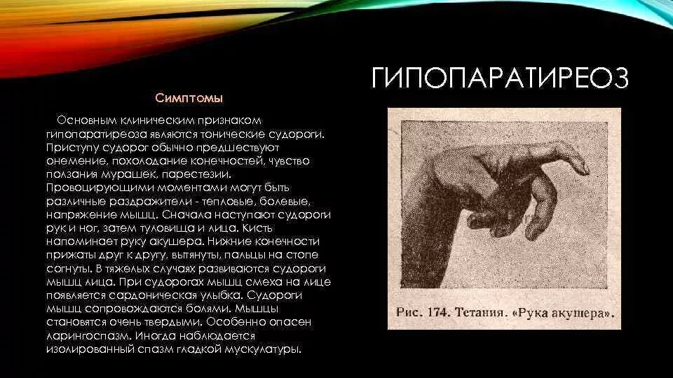 Гипопаратиреоз тетания. Гипопаратиреоз клинические проявления. Гипопаратиреоз осложнения. Симптомы при гипопаратиреозе.