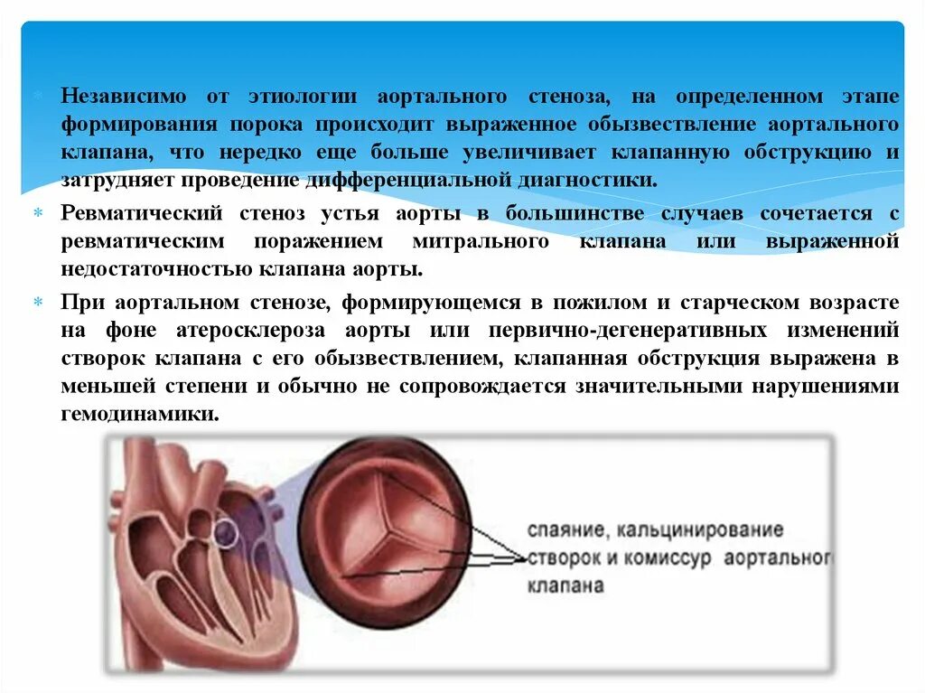 Кальцинирование створок клапанов сердца. Кальцинированный аортальный клапан. Аортальный стеноз презентация. Обызвествление аортального клапана.