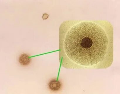 Днк mycoplasma hominis