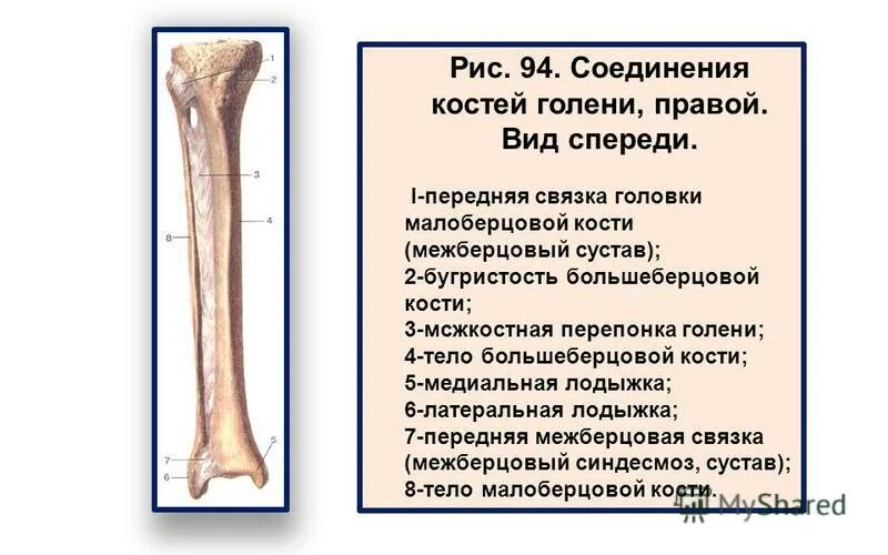 Берцовая и подвздошная кость. Соединение малоберцовой и большеберцовой кости. Синдесмоз малоберцовая кость. Малоберцовая кость соединения. Соединения костей голени межберцовый сустав.