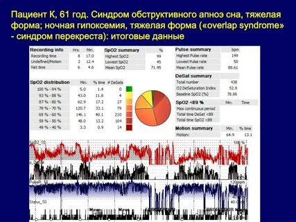 Оверлап синдром