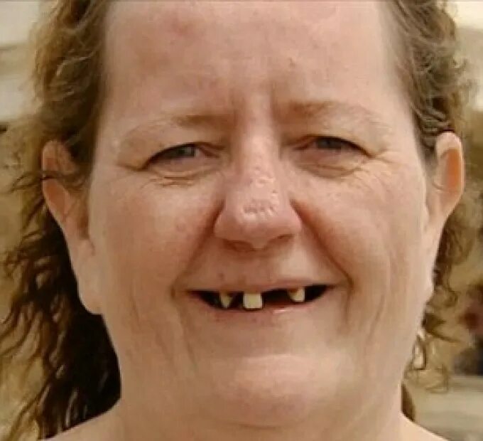 Oldest ugly. Oldest ugly