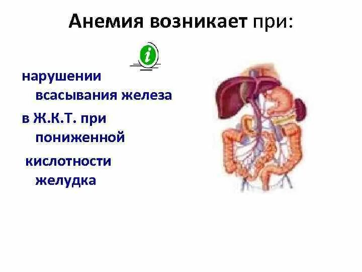 Нарушение всасывания железа. Нарушение всасывания железа при анемии. нарушение абсорбции железа. нарушение всасывания железа причины.