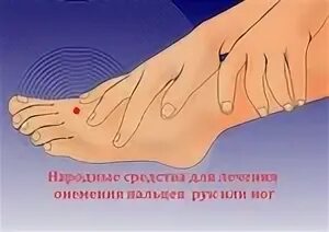 Немеют пальцы на левой ноге что делать