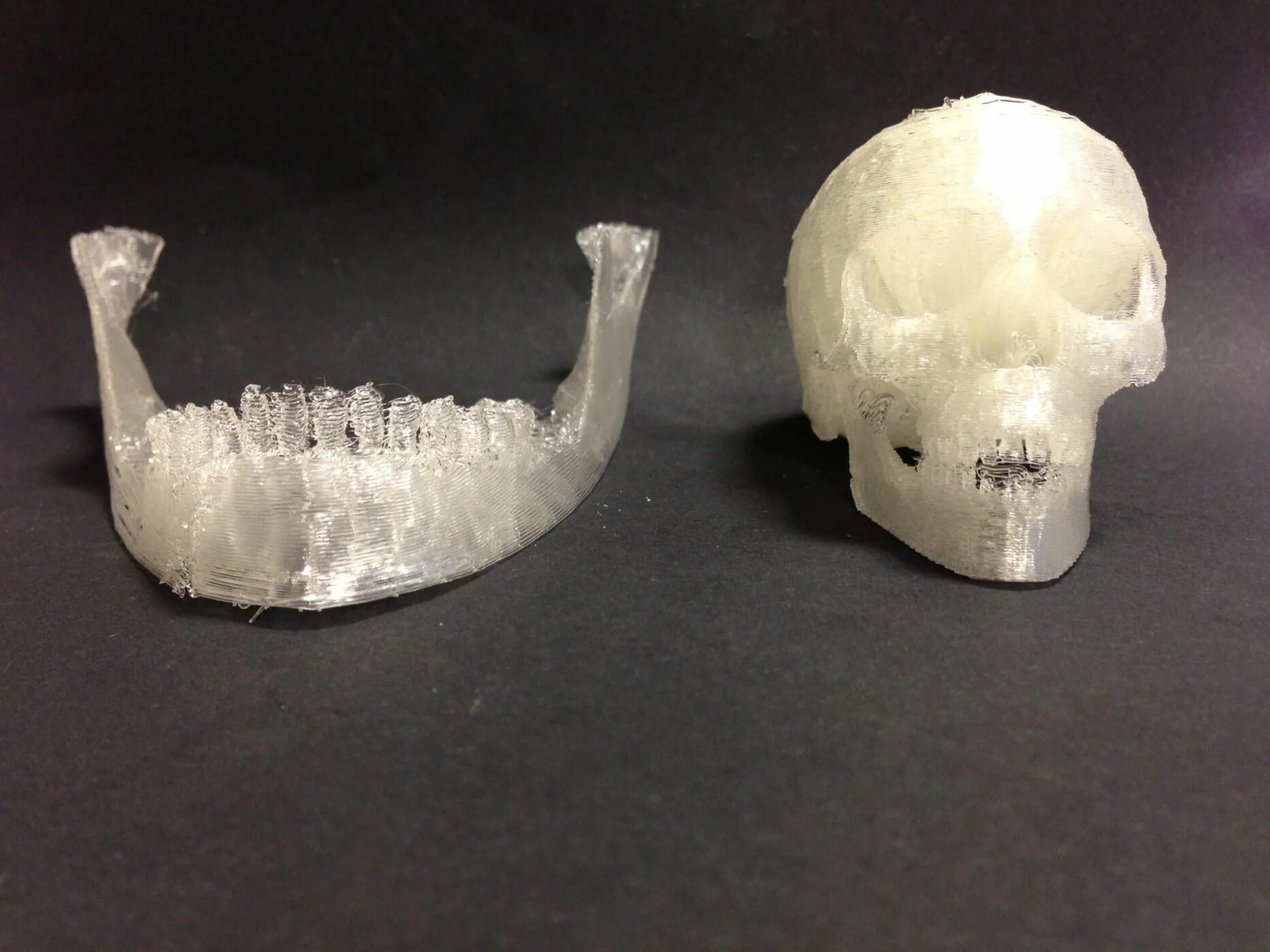 Напечатанные кости. 3d принтер череп протез. Стереолитографическая модель челюсти. Череп на 3d принтере. 3д принтер костей.