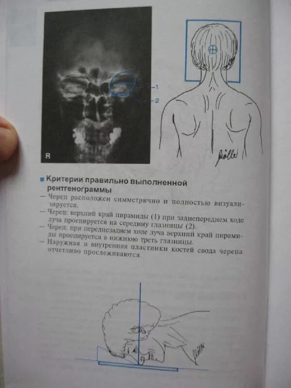 Фельдман атлас рентгенологических укладок. Атлас кишковского укладки. Укладки при рентгенологических исследованиях кишковский. Укладки при рентгенологических исследованиях кишковский. Рентгенография черепа в прямой проекции.