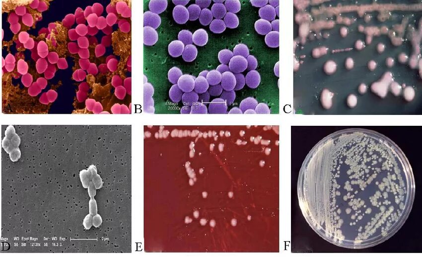 Enterococcus faecalis. Enterococcus faecalis