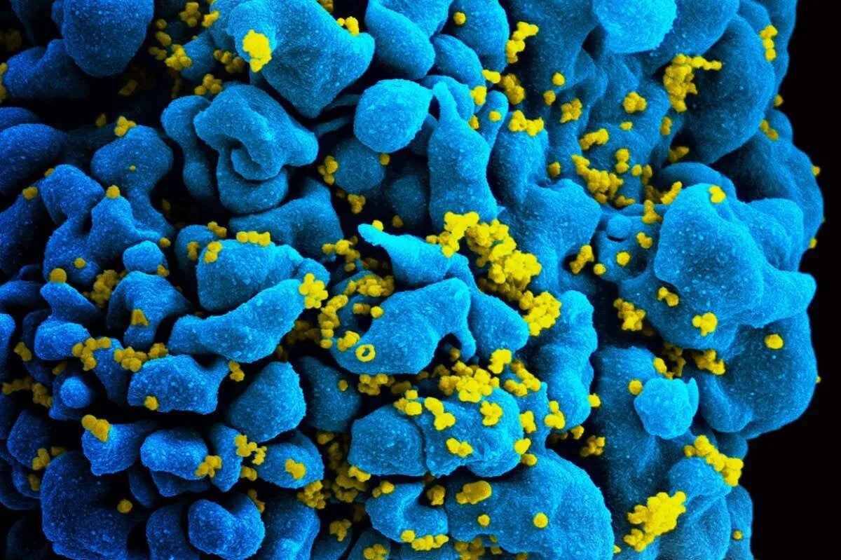 Т клеточный иммунодефицит. Штаммы ВИЧ. Букет ВИЧ. ВИЧ бактерия. Вирус ВИЧ под микроскопом.