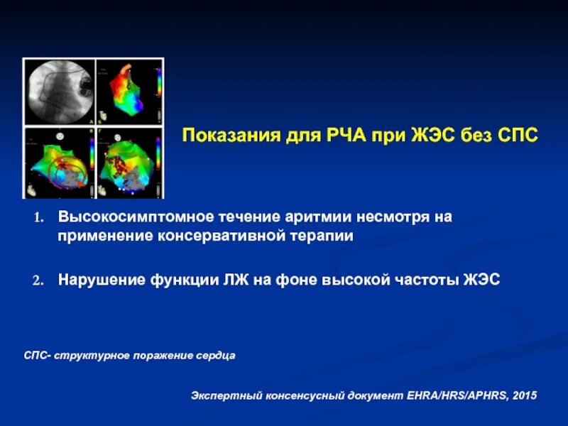Что такое рча. Показания к рча. радиочастотная катетерная абляция. катетерная абляция показания.