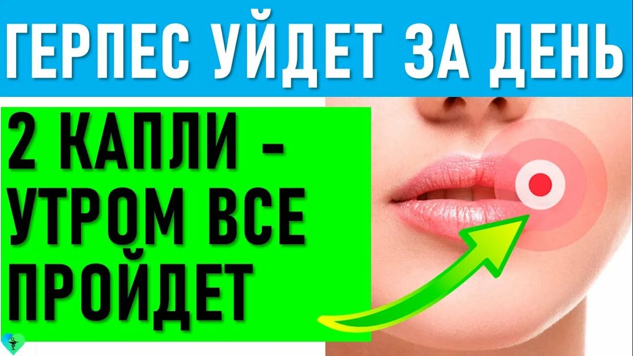 Герпес на губе лечение домашними средствами. Народное средство отгерписа. Народные средства от герпеса. Быстрое избавление от герпеса на губах. Как лечить герпес на губах быстро.