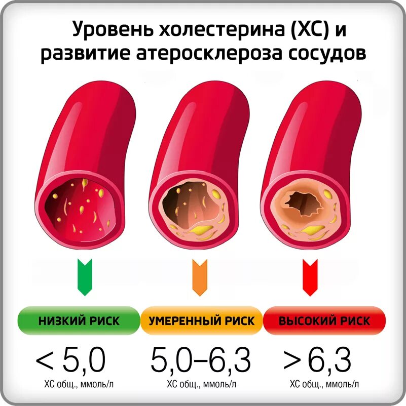 Холестерин что это такое