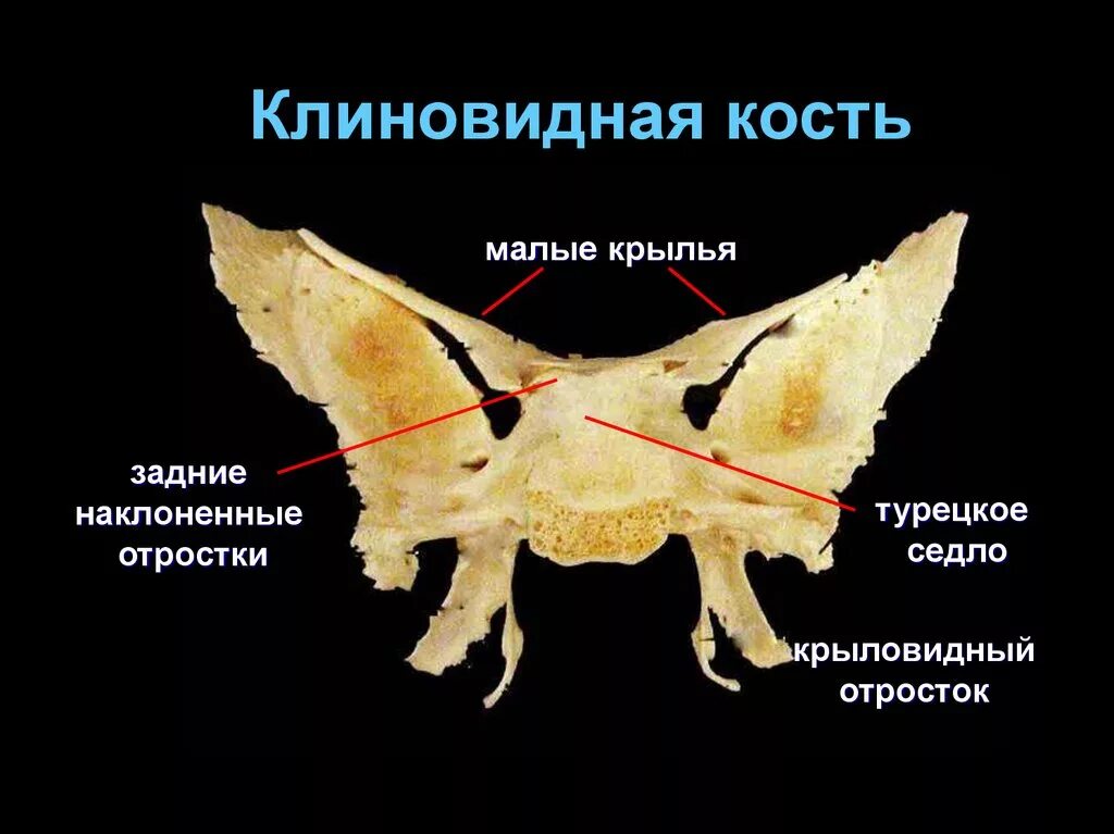 Турецкие седло кость. Клиновидная кость: большие Крылья и крыловидные отростки.. Турецкое седло клиновидной кости черепа. Крыловидный отросток клиновидной кости. Крыловидная ямка крыловидного отростка клиновидной кости.