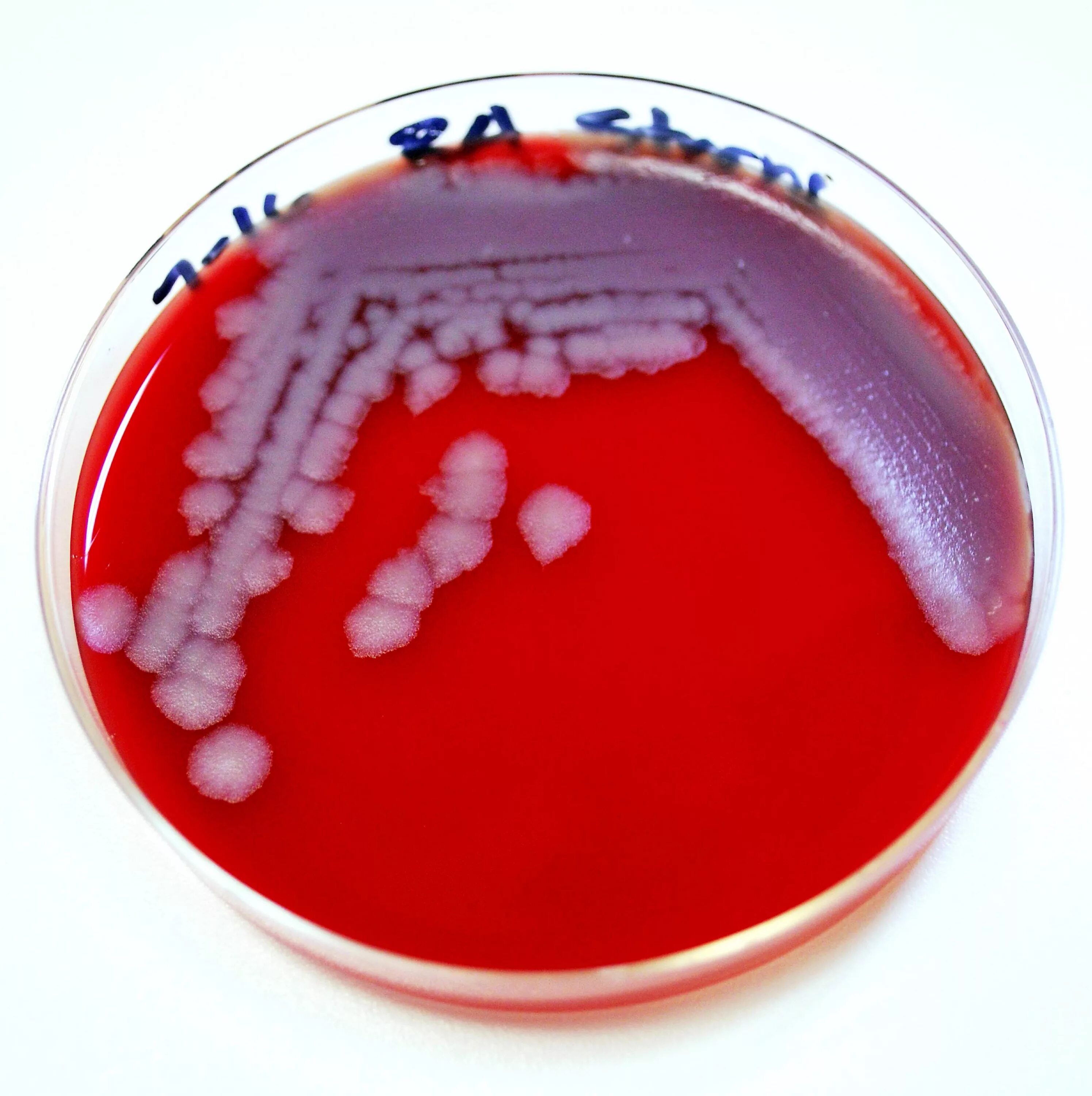 Bacillus anthracis Сибирская язва. Bacillus anthracis чистая культура.