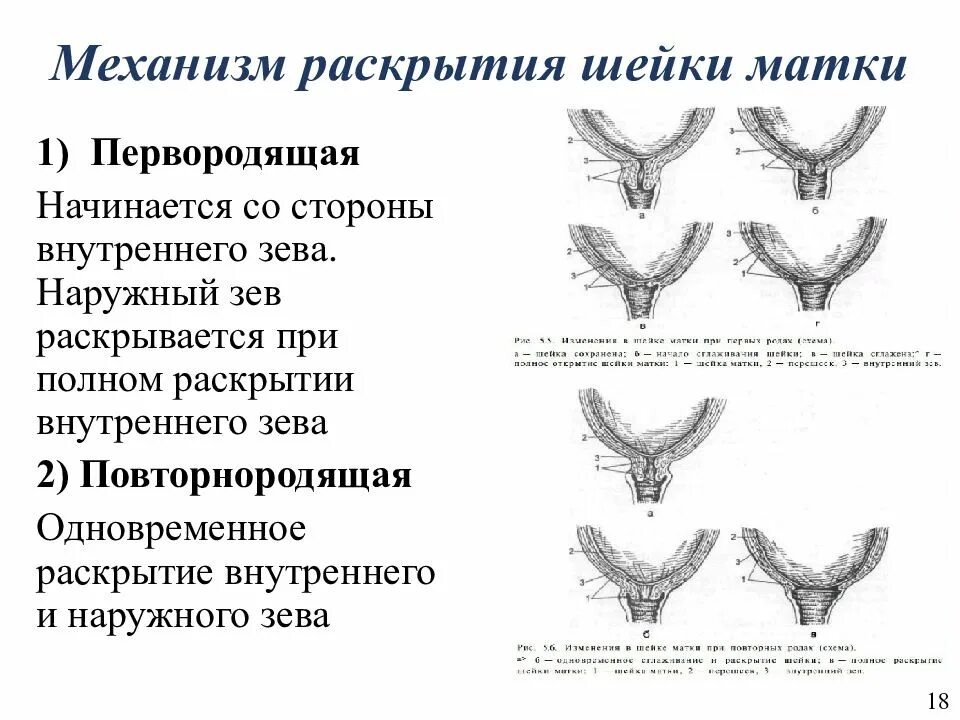 Маточный зев. Механизм раскрытия шейки матки. Механизм раскрытия шейки матки в родах. Механизм раскрытия маточного зева в родах. Факторы способствующие раскрытию шейки матки.