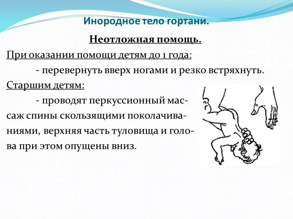 Первая помощь при попадании в глотку. Инородное тело в гортани первая помощь. Попадание инородного тела в гортань. Инородное тело гортани неотложная помощь. Оказание помощи при инородном теле гортани.