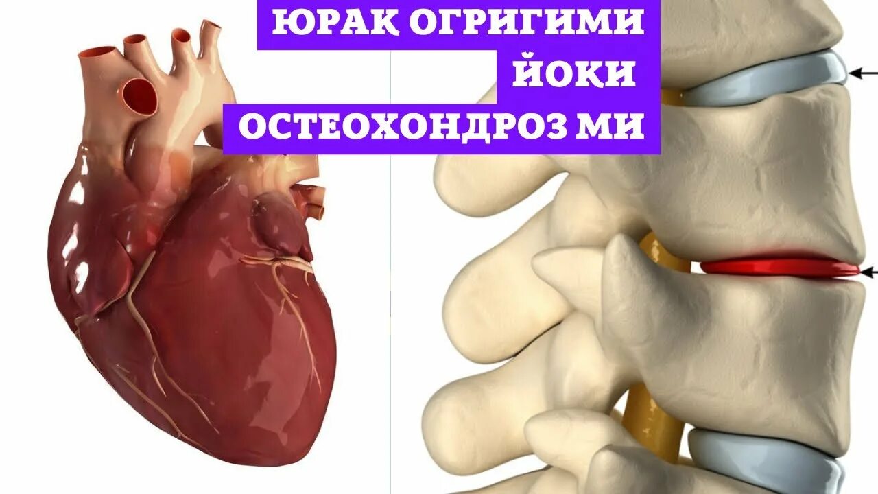 Содда юрак ишонгандия юрагимда. Юрак.огриги. остеохондроз касаллиги белгилари. юрак касалликлари белгилари. юрак касалликлари белгилари аломатлари.