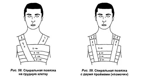 Наложение круговой повязки