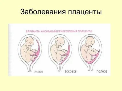 Предохраняет плод от механических повреждений