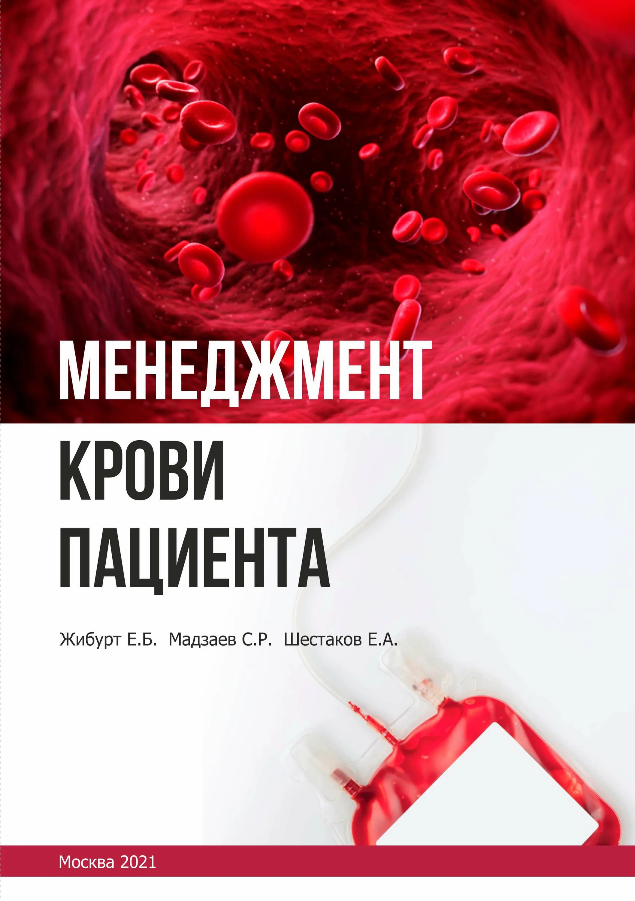 Гемостазиология. Менеджмент крови пациента Жибурт. Книги по гемостазиологии. Клиническая гемостазиология. Жибурт книги.