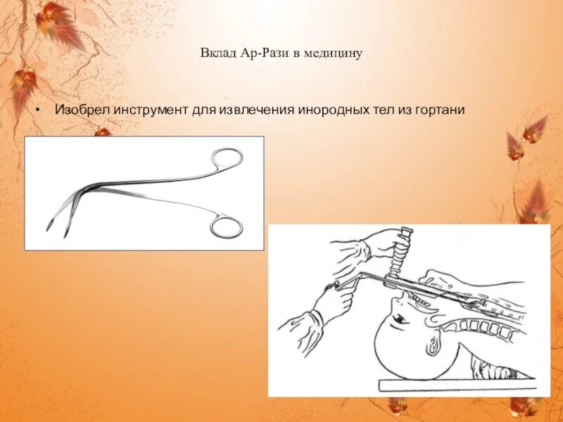 Ар-рази вклад в медицину. Медицинский прибор для удаления инородного тела из гортани. Щипцы гортанные для извлечения инородных тел 20 см. Разит значение