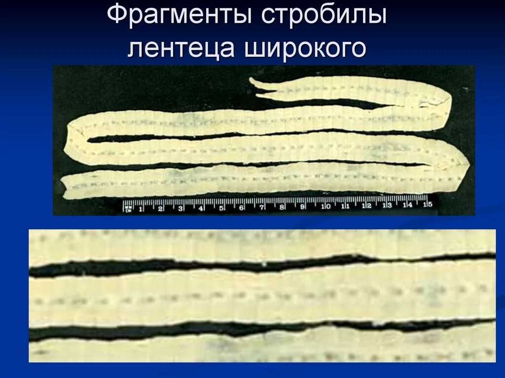 Червь широкий лентец. Ленточные черви широкий лентец. Ленточный червь лентец. Фрагмент стробилы лентеца широкого. Ленточные черви членики.