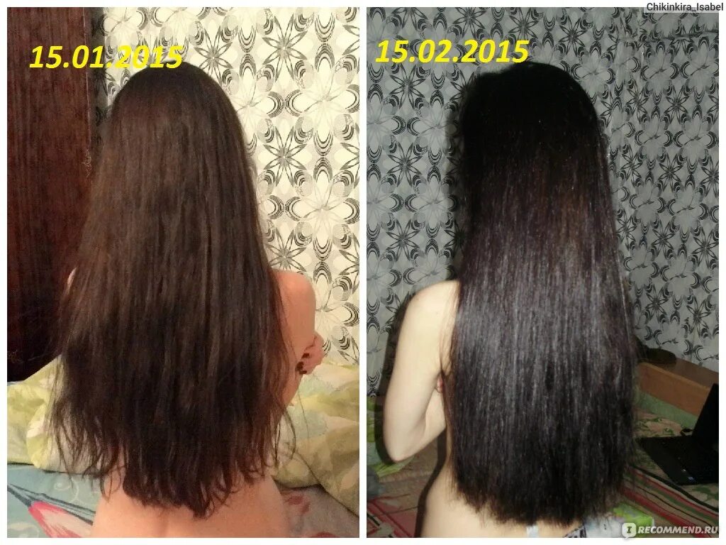 Никотиновая кислота рост волос эффект. Отращивание волос до и после. Отрастить волосы никотиновой кислотой. Волосы за 4 месяца. Irecommend волосы