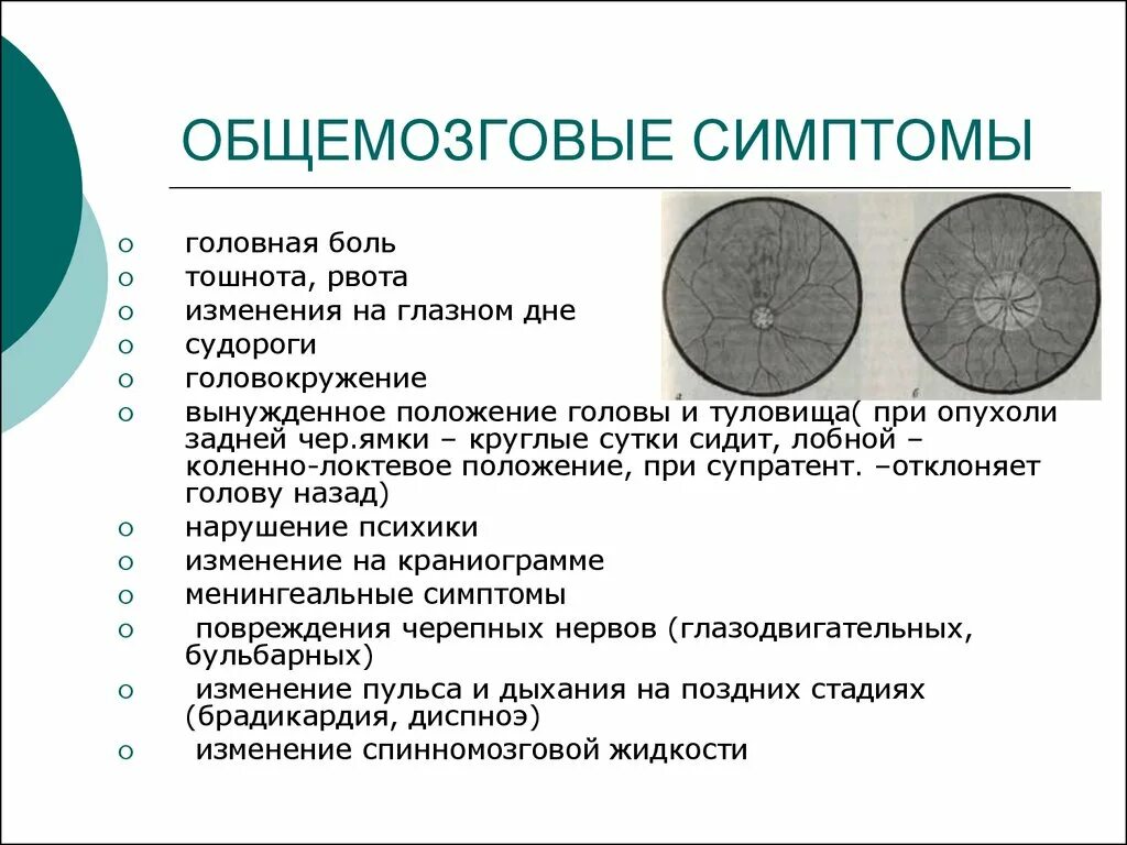 Рак мозга сколько стадий. Начальные симптомы опухоли головного мозга. Опухоль мозга 1 стадии признаки. Опухоли головного мозга сим. Общемозговые симптомы при опухолях головного мозга.