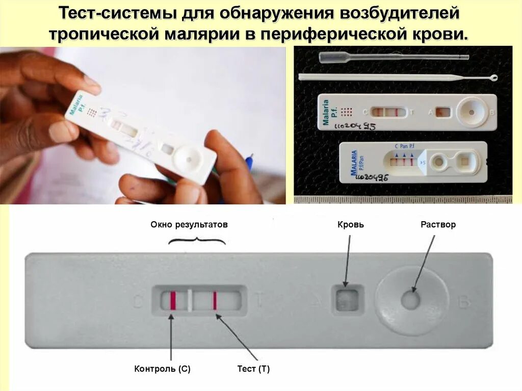 Малярия тестирование. Экспресс тест на малярию. ИХА тест на малярию. Экспресс методы диагностики малярии. Малярия ИХА.