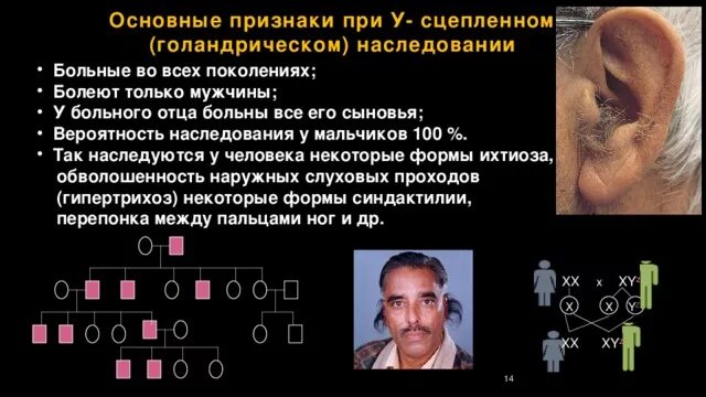 Голандрический тип наследования примеры Типы наследования ГЕНЕТИКА